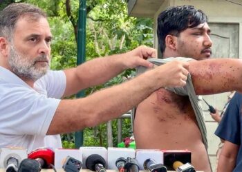 Rahul Gandhi का केंद्र पर बड़ा हमला, बोले- 'धर्मेंद्र प्रधान को जाना ही होगा', पैलेट गन पीड़ित छात्र के साथ रखीं 3 मांगें